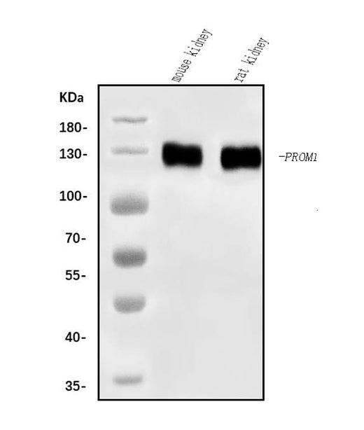 Anti-CD133/Prom1 Antibody Picoband® Boster Bio