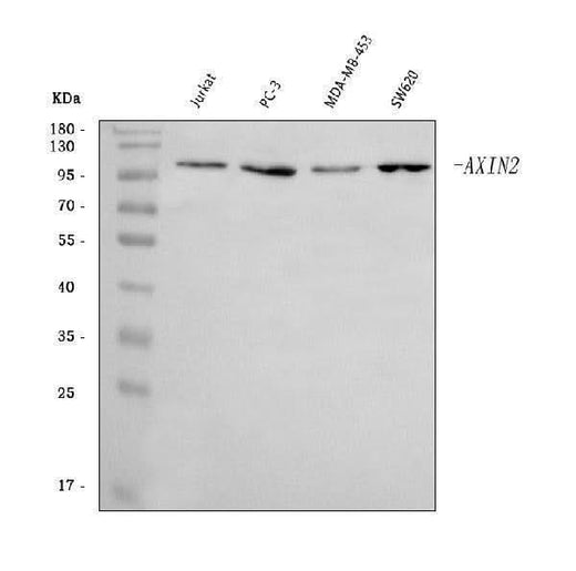 Anti-Axin 2/AXIN2 Antibody Picoband® Boster Bio