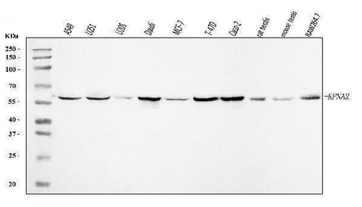 Anti-KPNA2 Antibody Picoband® Boster Bio