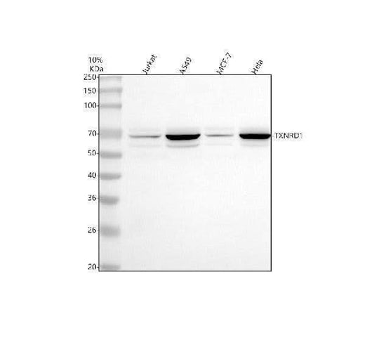 Anti-TXNRD1 Antibody Picoband® Boster Bio