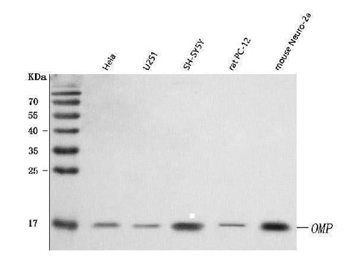 Anti-OMP Antibody Picoband® Boster Bio
