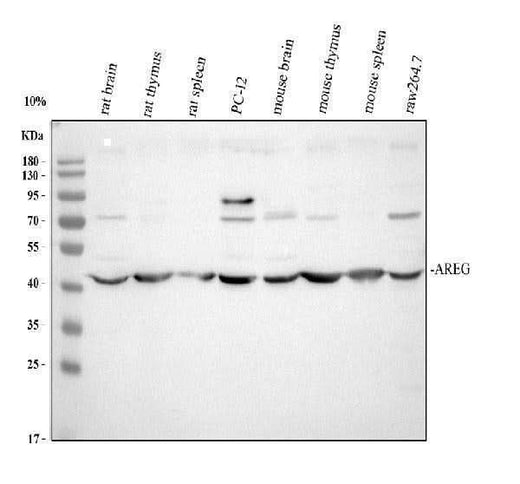 Anti-Amphiregulin/Areg Antibody Picoband® Boster Bio