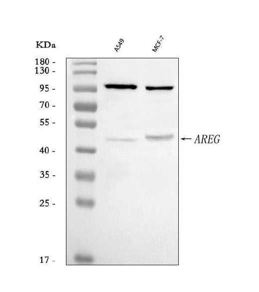 Anti-Amphiregulin/AREG Antibody Picoband® Boster Bio