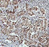 Anti-PTBP1 Antibody Picoband® Boster Bio