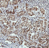 Anti-PTBP1 Antibody Picoband® Boster Bio