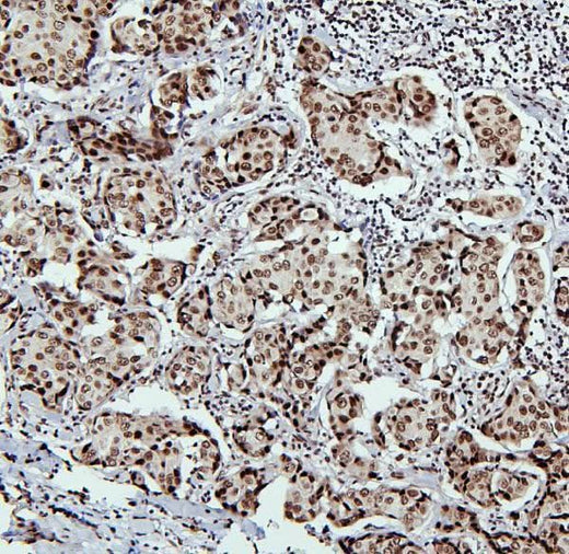 Anti-PTBP1 Antibody Picoband® Boster Bio