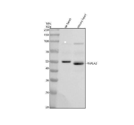 Anti-PNPLA2 Antibody Picoband® Boster Bio