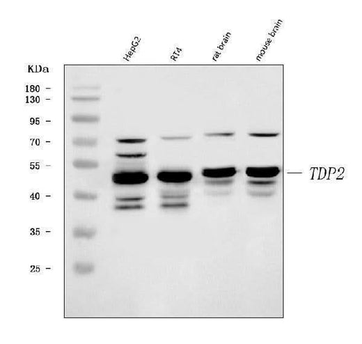 Anti-TDP2 Antibody Picoband® Boster Bio