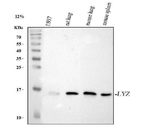 Anti-Lysozyme/LYZ Antibody Picoband® Boster Bio