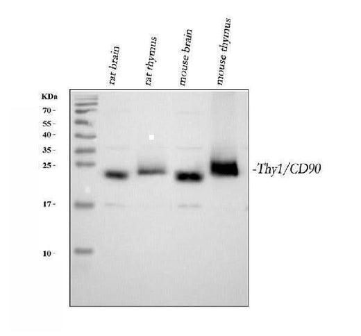 Anti-CD90/Thy1 Antibody Picoband® Boster Bio