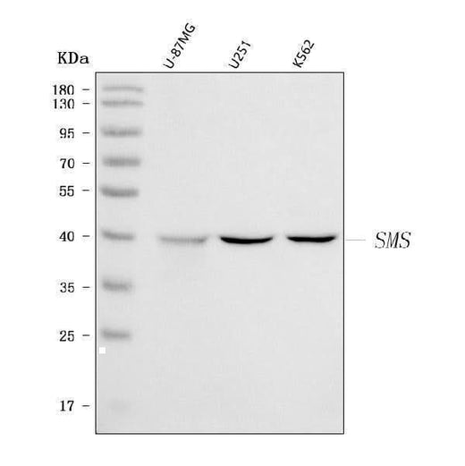 Anti-Spermine synthase/SMS Antibody Picoband® Boster Bio