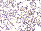 Anti-BMP15 Antibody Picoband® Boster Bio