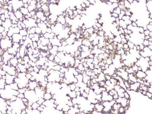 Anti-BMP15 Antibody Picoband® Boster Bio