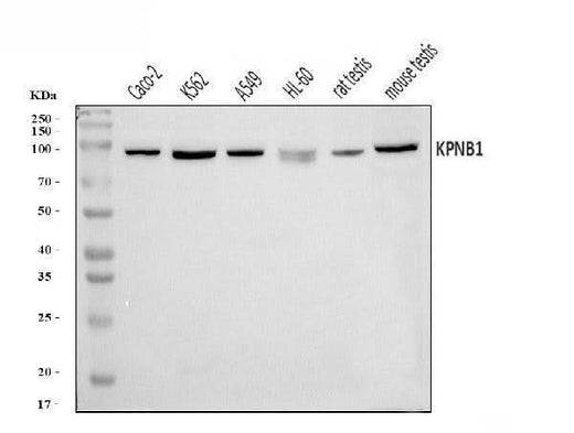 Anti-KPNB1 Antibody Picoband® Boster Bio