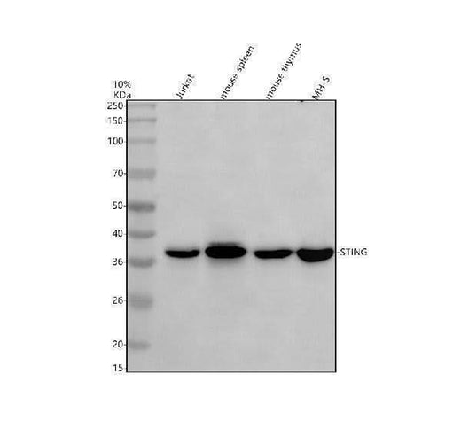 Anti-TMEM173/STING Antibody Picoband® Boster Bio