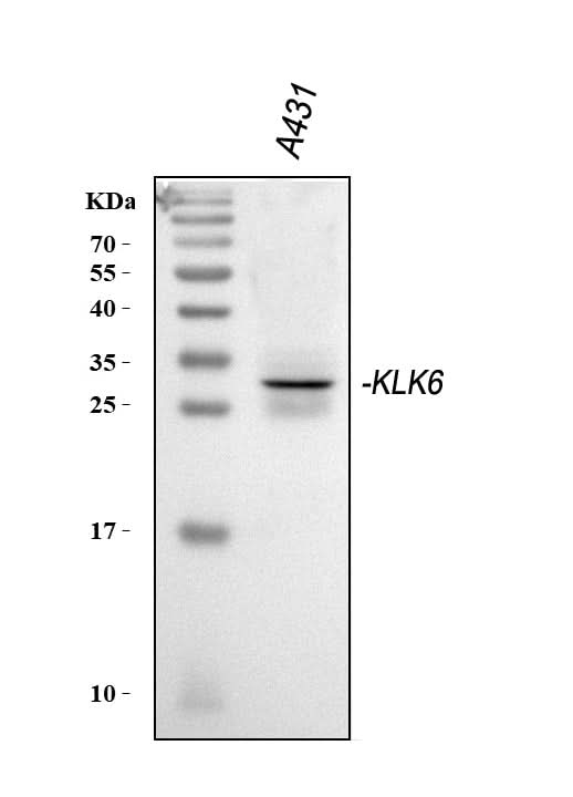 Anti-Kallikrein 6/KLK6 Antibody Picoband® Boster Bio
