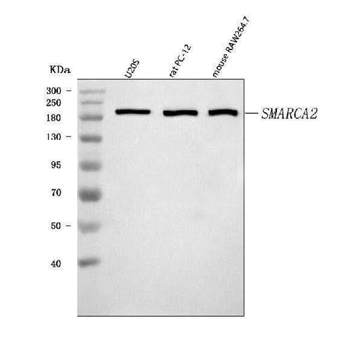 Anti-SMARCA2/BRM Antibody Picoband® Boster Bio