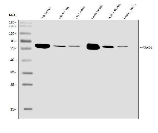 Anti-CAMKIV/Camk4 Antibody Picoband® Boster Bio