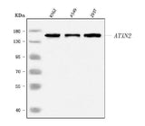 Anti-SCA2/ATXN2 Antibody Picoband® Boster Bio