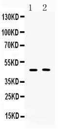 Anti-Protein C inhibitor/SERPINA5 Antibody Picoband® Boster Bio