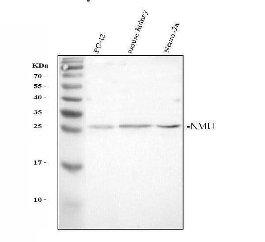 Anti-NMU Antibody Picoband® Boster Bio