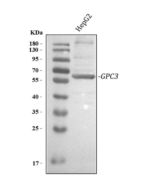 Anti-Glypican 3/GPC3 Antibody Picoband® Boster Bio