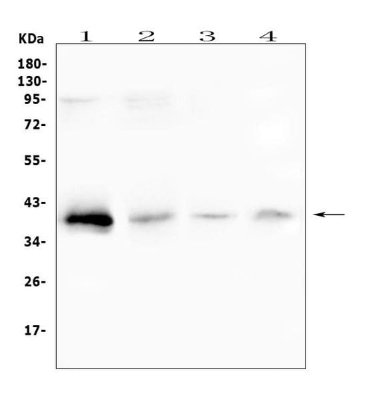 Anti-RP2 Antibody Picoband® Boster Bio