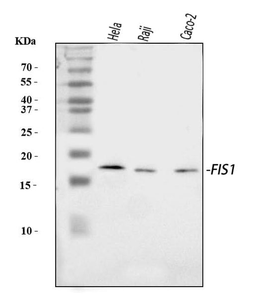 Anti-TTC11/FIS1 Antibody Picoband® Boster Bio
