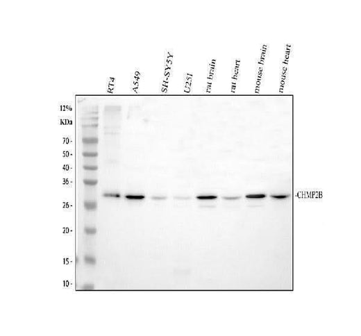 Anti-CHMP2B Antibody Picoband® Boster Bio