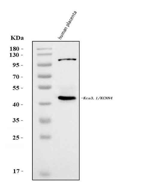Anti-KCNN4 Antibody Picoband® Boster Bio