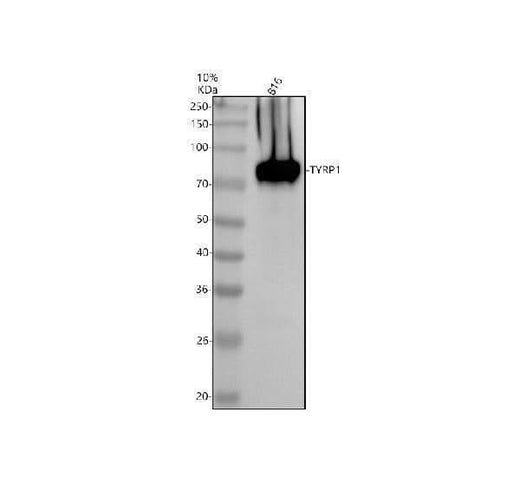 Anti-TYRP1 Antibody Picoband® Boster Bio