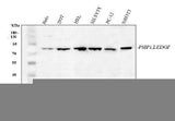 Anti-PSIP1 Antibody Picoband® Boster Bio