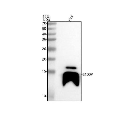 Anti-S100P Antibody Picoband® Boster Bio