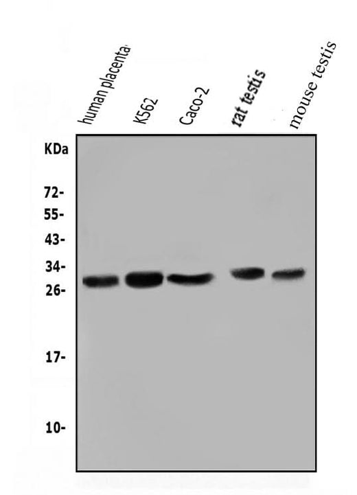 Anti-Lin28/LIN28A Antibody Picoband® Boster Bio