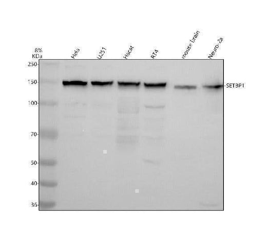 Anti-SETBP1 Antibody Picoband® Boster Bio