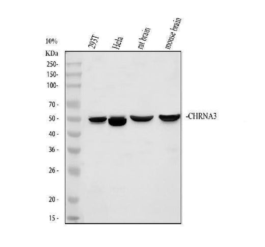 Anti-Nicotinic Acetylcholine Receptor alpha 3/CHRNA3 Antibody Picoband® Boster Bio