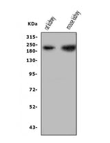 Anti-Nephrin/NPHS1 Antibody Picoband® Boster Bio