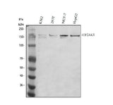 Anti-PERK/EIF2AK3 Antibody Picoband® Boster Bio