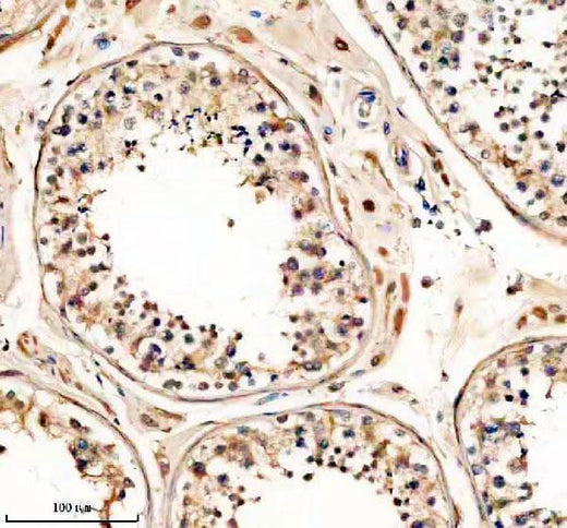 Anti-PTGDS Antibody Picoband® Boster Bio