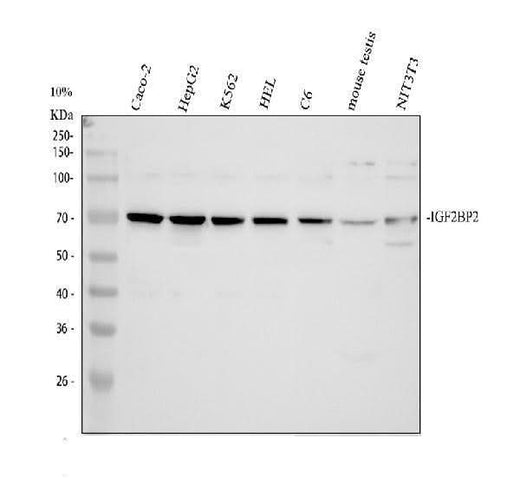 Anti-IGF2BP2 Antibody Picoband® Boster Bio