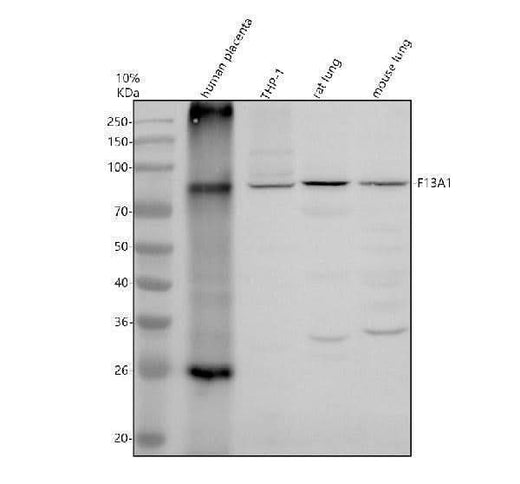 Anti-Factor XIIIa/F13A1 Antibody Picoband® Boster Bio