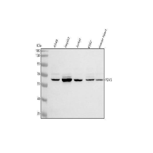 Anti-PGM3 Antibody Picoband® Boster Bio