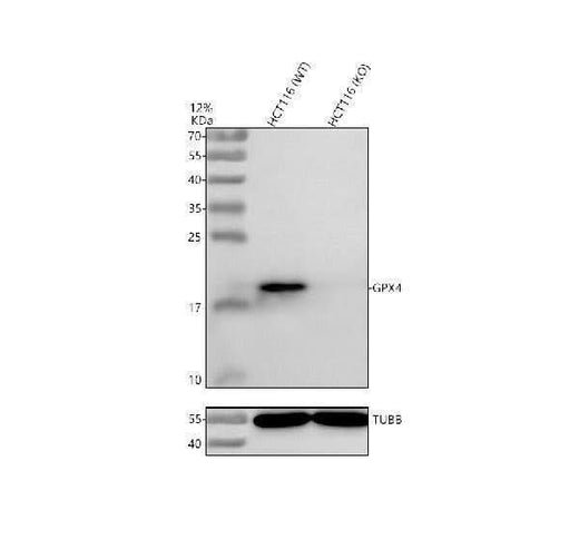 Anti-Glutathione Peroxidase 4/GPX4 Antibody Picoband® Boster Bio