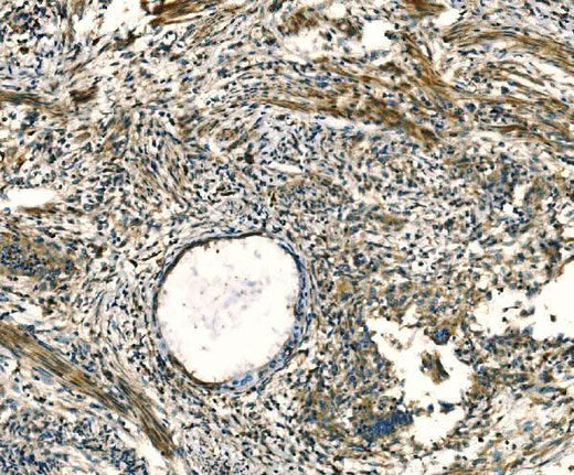 Anti-Apelin/APLN Antibody Boster Bio