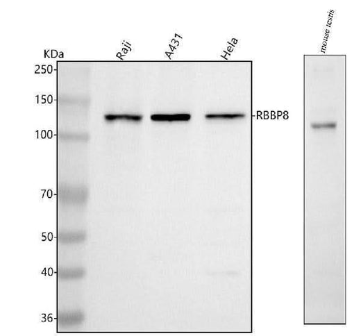 Anti-RBBP8 Antibody Picoband® Boster Bio