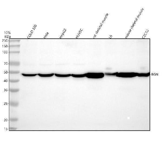 Anti-Biglycan/BGN Antibody Picoband® Boster Bio