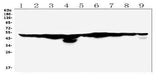 Anti-FH Antibody Picoband® Boster Bio