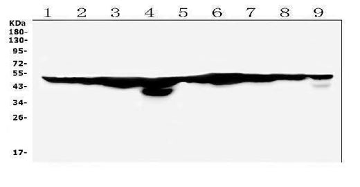 Anti-FH Antibody Picoband® Boster Bio