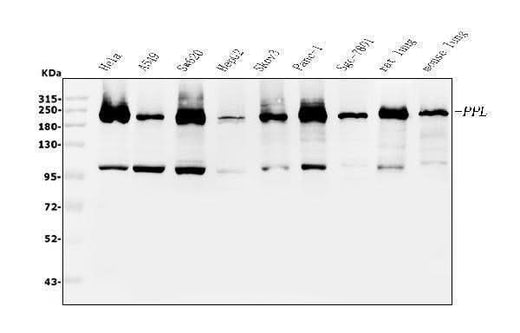 Anti-Periplakin/PPL Antibody Picoband® Boster Bio