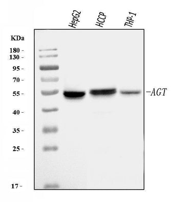 Anti-Angiotensinogen/AGT Antibody Picoband® Boster Bio